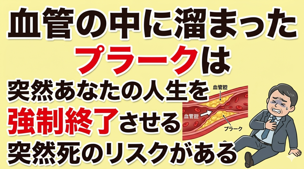 血管の中に溜まった「プラーク」は突然あなたの人生を強制終了させる